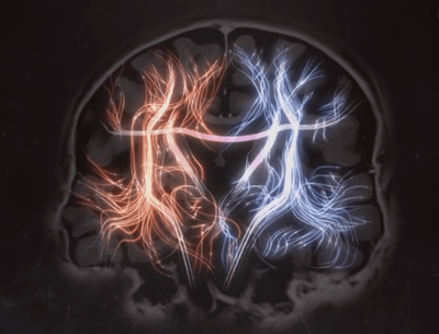 tractography