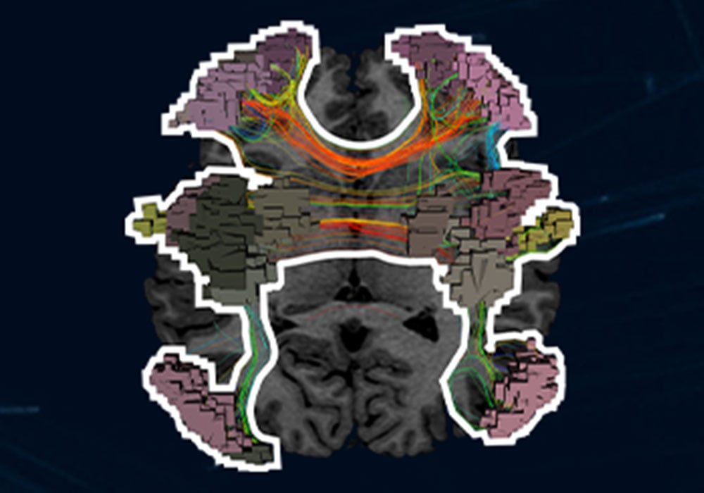 Brain network library